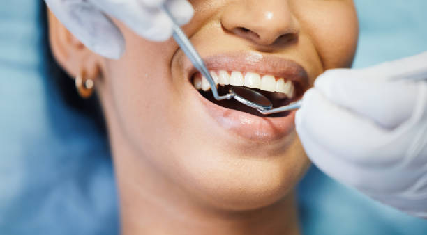 Best Broken or Cracked Tooth Emergency Dentist in Progreso, TX