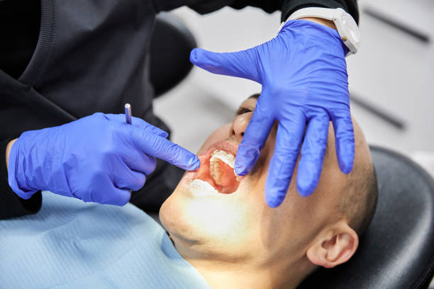 Best Emergency Dentist for Knocked-Out Tooth in Progreso, TX